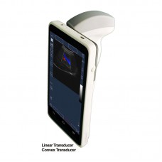 Handheld Ultrasound Scanner